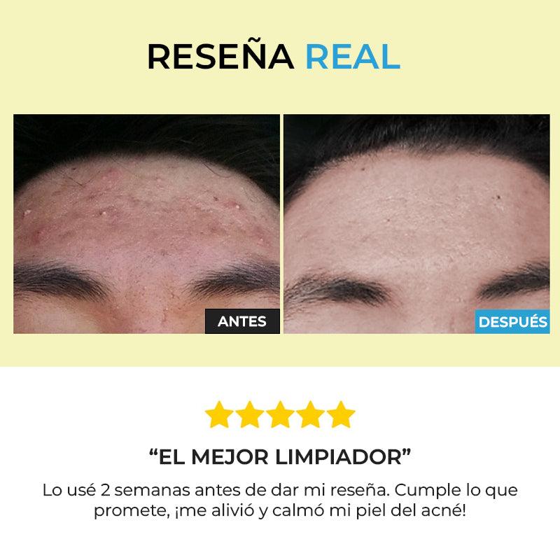 Gel limpiador de CosRX - Low pH Good Morning Gel Cleanser - Arumi Korean Cosmetics